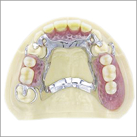 金属床部分義歯